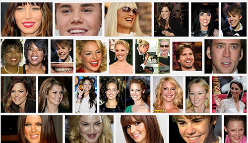 Invisalign celebrities