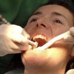 Private: In New Research at King’s College London Dentists Aim for Drill-free Future
