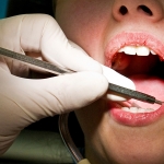 Private: New Tooth Decay Treatment in the News: Available within 3 Years 