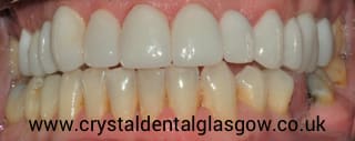 cosmetic dentistry patient in glasgow 5