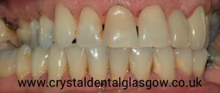 cosmetic dentistry patient in glasgow