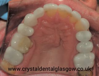 cosmetic dentistry patient in glasgow 4