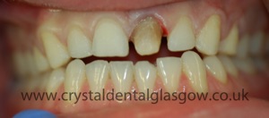 cosmetic dentistry case 1