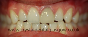 cosmetic dentistry case 2