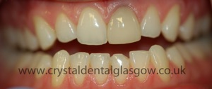 cosmetic dentistry case 3
