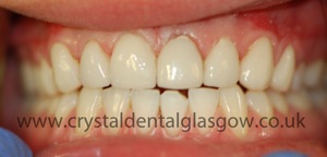 cosmetic dentistry case 4
