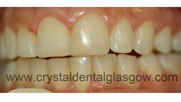 cosmetic dentistry results after