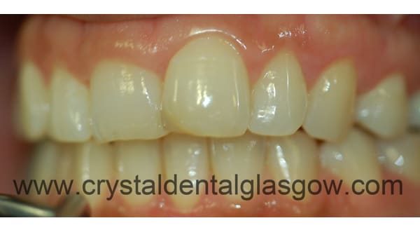 cosmetic dentistry results 1