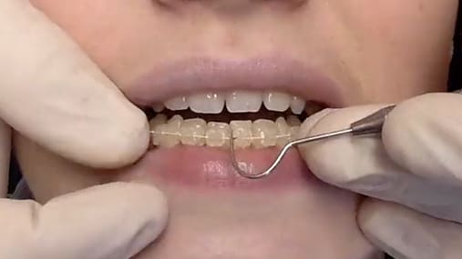 orthodontic patient