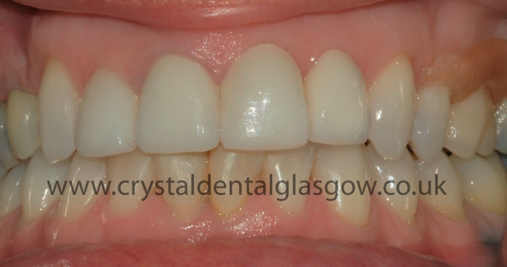 A lovely cosmetic dentistry result