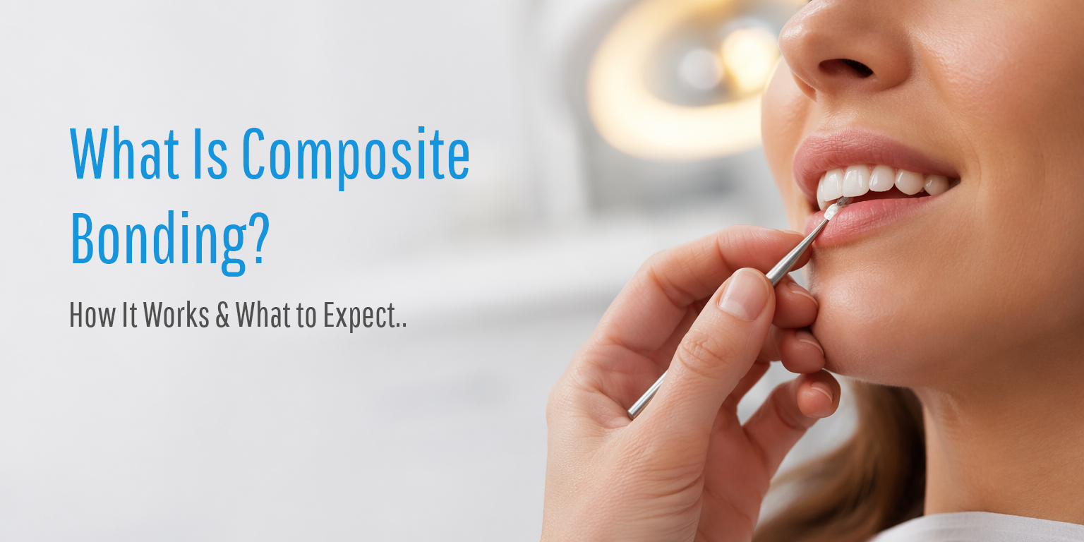 What Is Composite Bonding